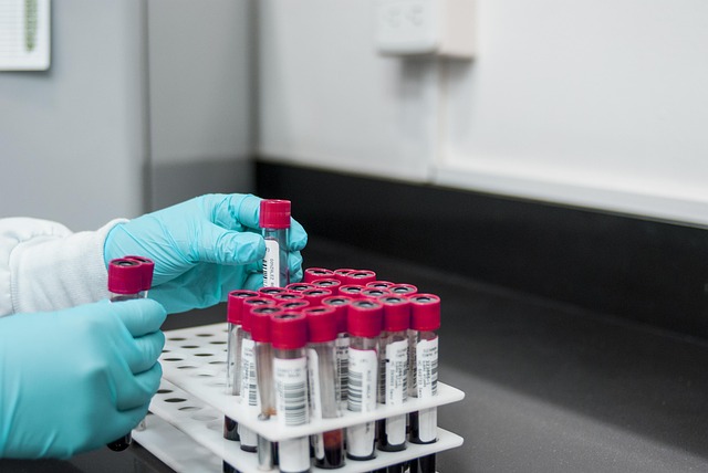 New Blood Test Detects Alzheimer's with 90% Accuracy as Scottish Researchers Lead the Way